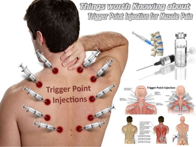 Local and "trigger point" injections